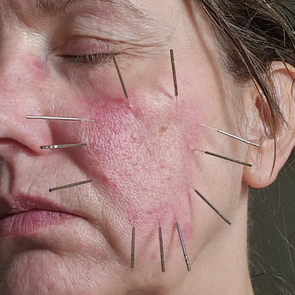 anti aging 3,1