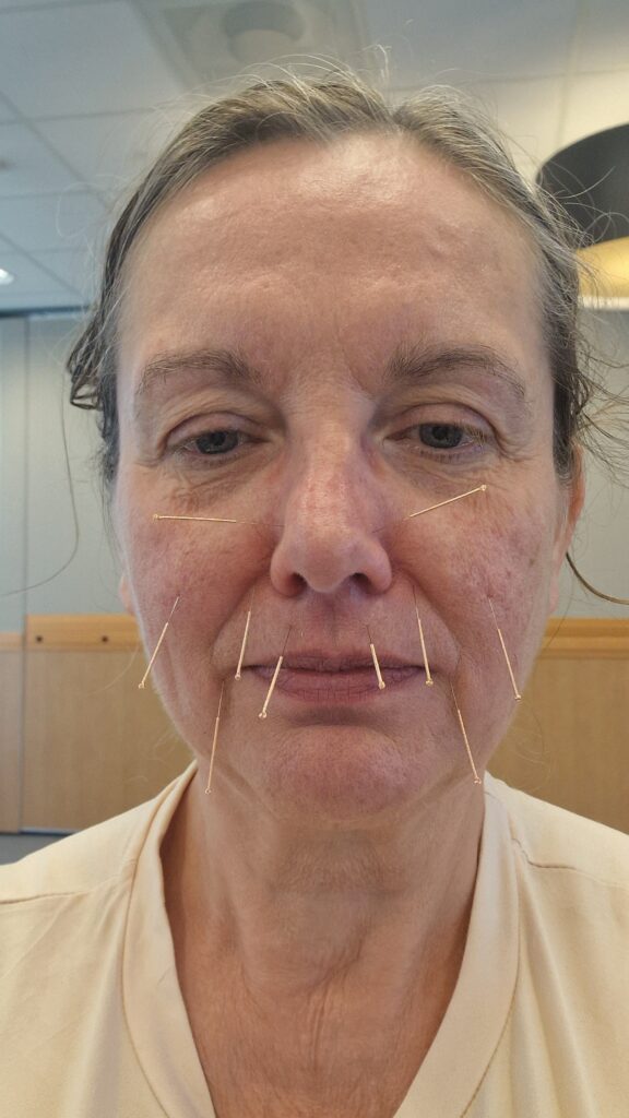 anti aging 5