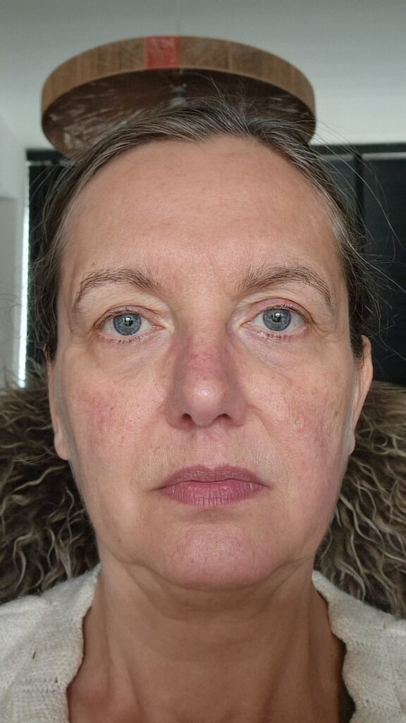 anti aging week 1