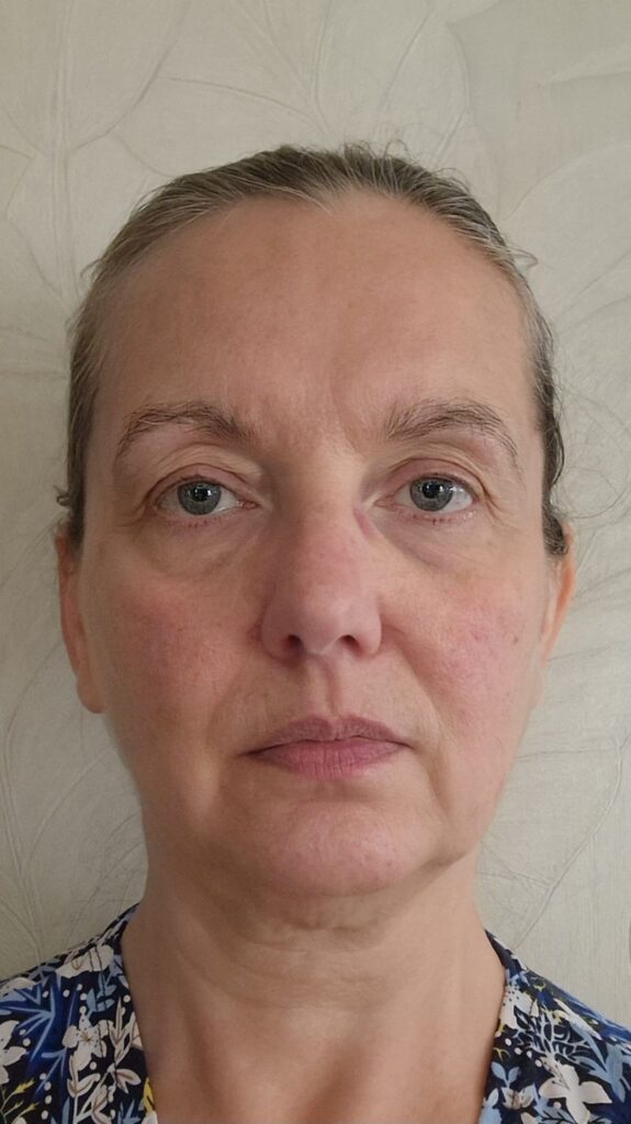 anti aging week 2