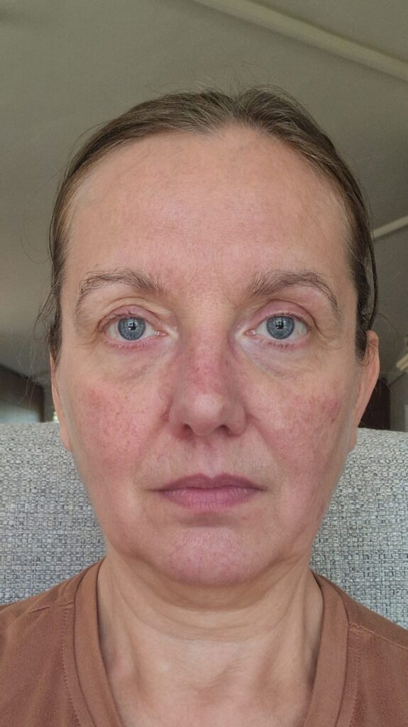 anti aging week 3